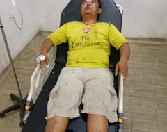 Wartawan Alami Tindak Penganiayaan Dengan Tuduhan Pencurian, Kuasa Hukum Desak Polrestabes Medan Segera Tangkap Pelaku