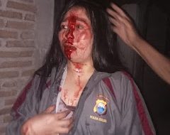 ODGJ di Mamasa Mengamuk, Seorang IRT Jadi Korban Penganiayaan