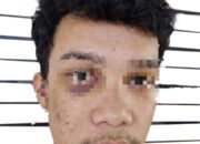 Tiga Tersangka Masih Bebas Berkeliaran, Pelapor Penganiayaan Berat Minta Polrestabes Medan Tangkap 3 Pelaku Lainnya