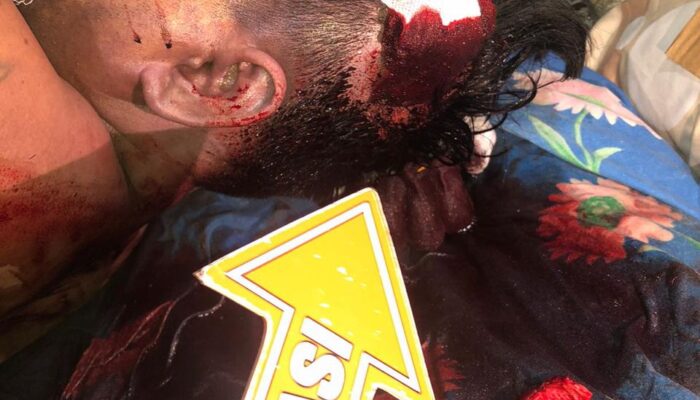 Keributan di Diskotik Palembang Berujung Maut, Satu Korban Tewas Akibat Luka Tusuk di Kepala